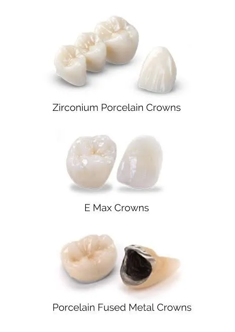 Clinician carrying out prosthodontics at Aurum Dental Clinic