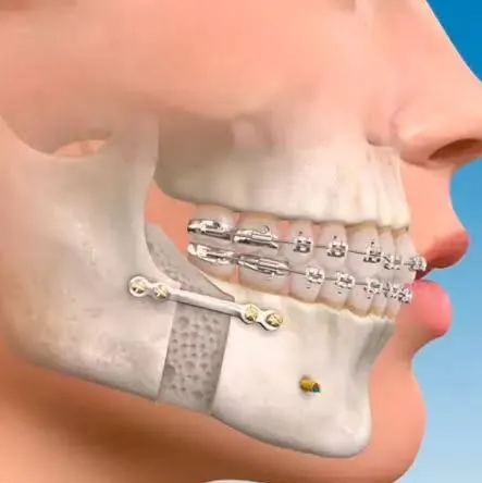 Clinician carrying out facial traumatic surgeries at Aurum Dental Clinic