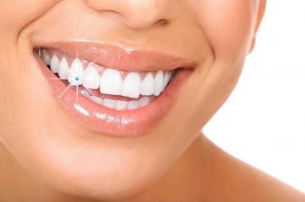 Clinician carrying out tooth diamonds at Aurum Dental Clinic